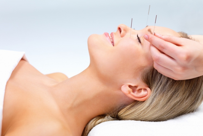 Tout ce que vous devez savoir sur l'acupuncture