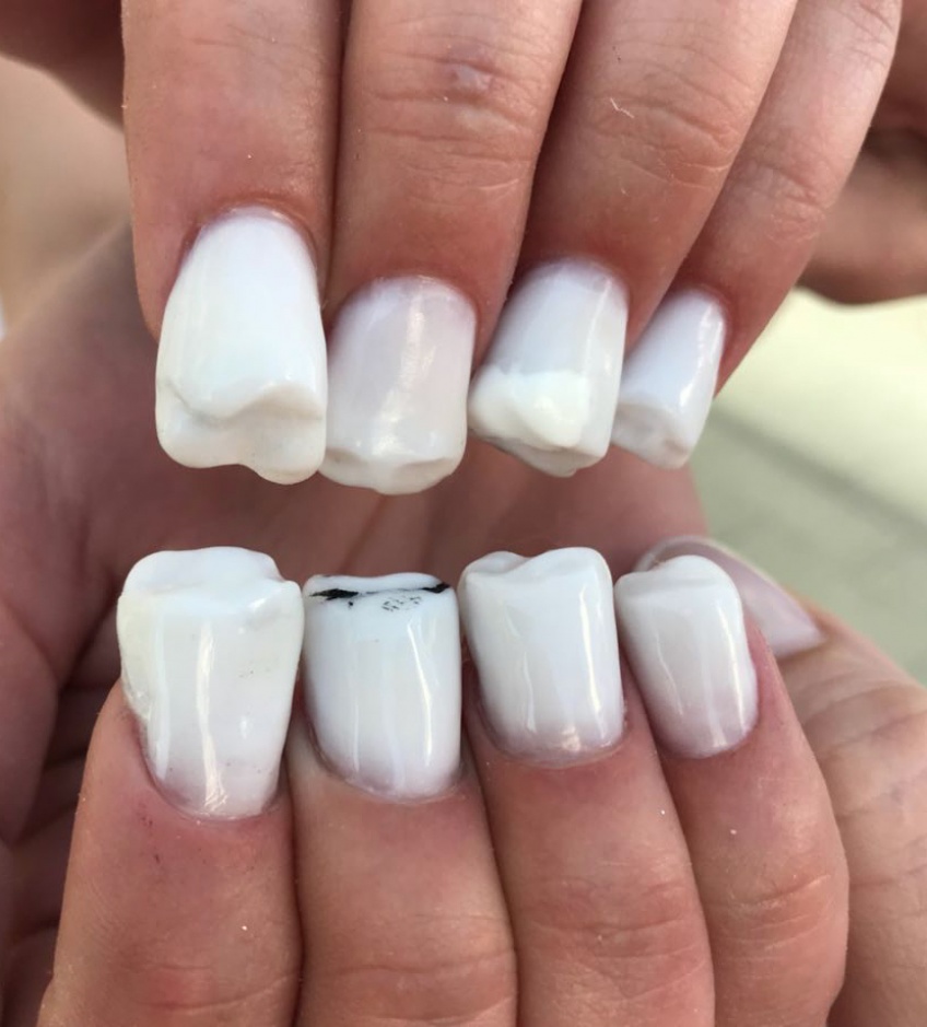 Le Molar Nails, la manucure qui affole Instagram !