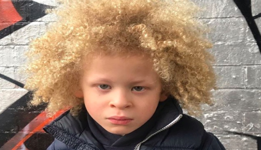 Ce petit garçon albinos devient égérie Primark !