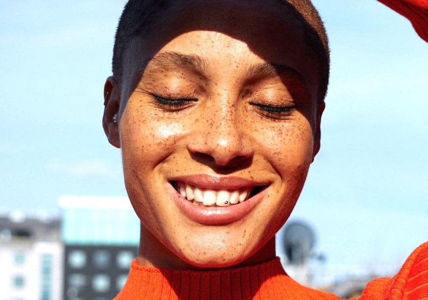 Adwoa Aboah, mannequin dévoile son acné et décide de s'accepter sur les réseaux sociaux !
