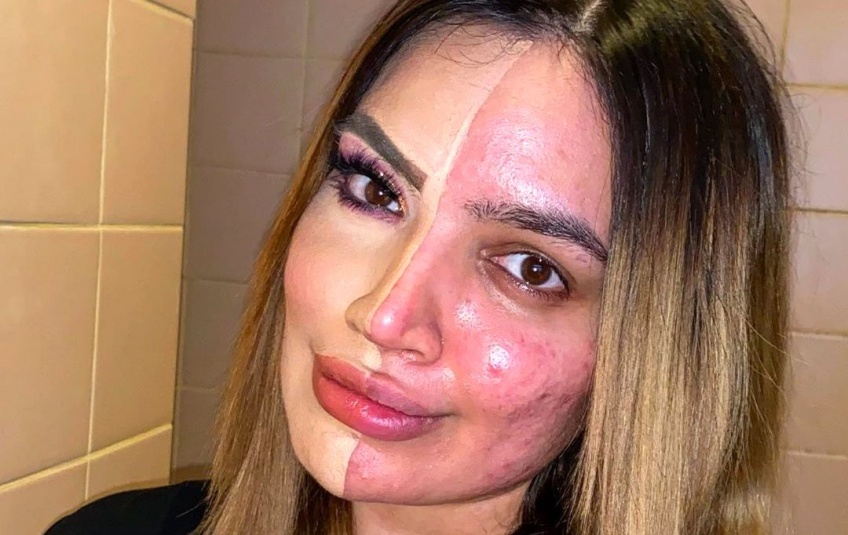 #BODYGLORY : Découvrez Kadeeja, celle qui se bat pour le skin positive sur Instagram
