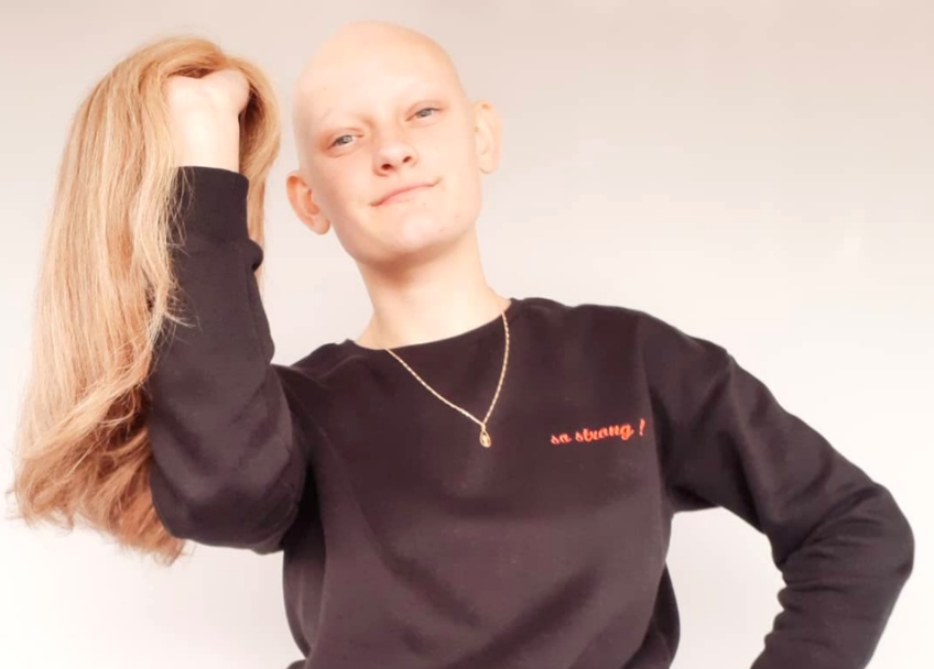 #Bodyglory : Pauline, la jeune femme qui assume fièrement son alopécie !