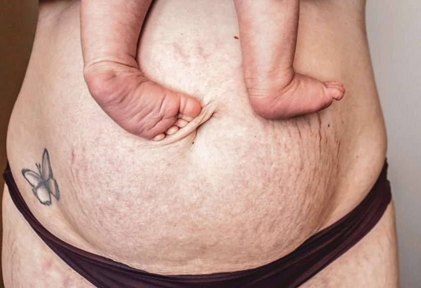 #BodyGlory: cette jeune maman envoie un message fort en montrant son corps après son accouchement !