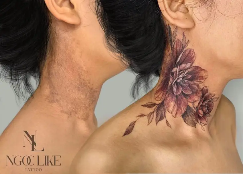 Une artiste recouvre des cicatrices avec des tatouages !