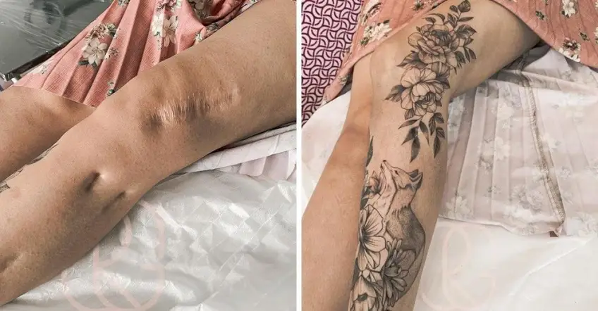 Ces cicatrices transformées en magnifiques tatouages !