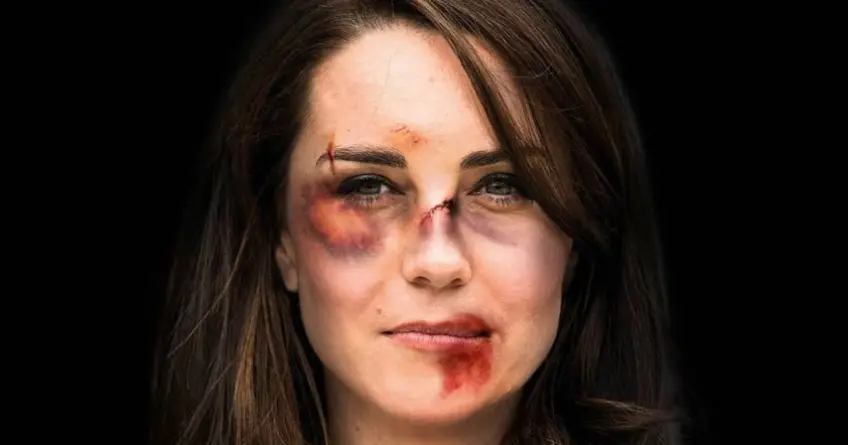 Violences conjugales : Kate Middleton pose le visage tuméfié dans une campagne de sensibilisation
