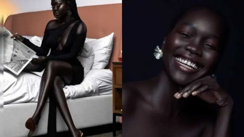 #BodyGlory : Nyakim Gatwech, la mannequin qui a réalisé son rêve !