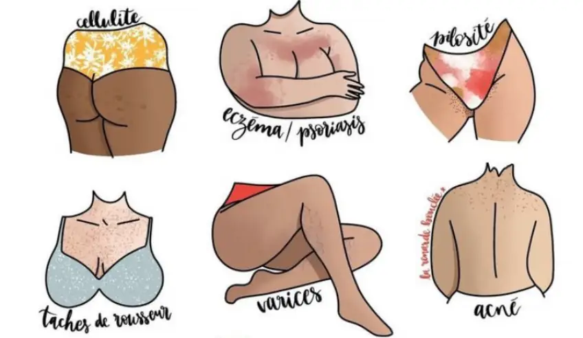 Ces illustrations montrent que tous les corps sont beaux !
