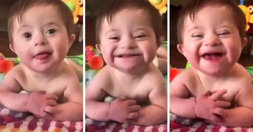 Ce bébé atteint du syndrome de Down offre à sa mère son premier sourire !