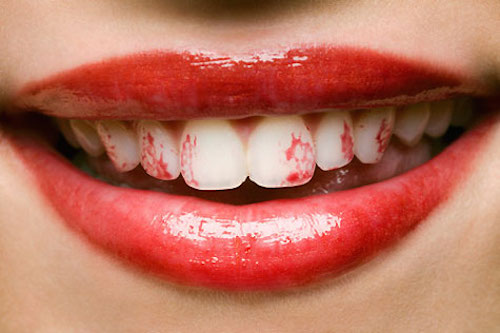 rouge à lèvre sur les dents